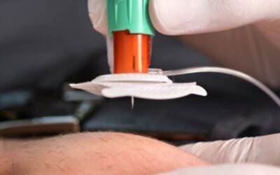 Rehydrationstherapie: Wichtige Hilfe bei Hitze – auch zu Hause